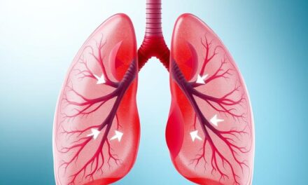 Choroby obturacyjne: objawy, diagnostyka i leczenie POChP