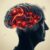Choroba Alzheimera: objawy, czynniki ryzyka i metody leczenia